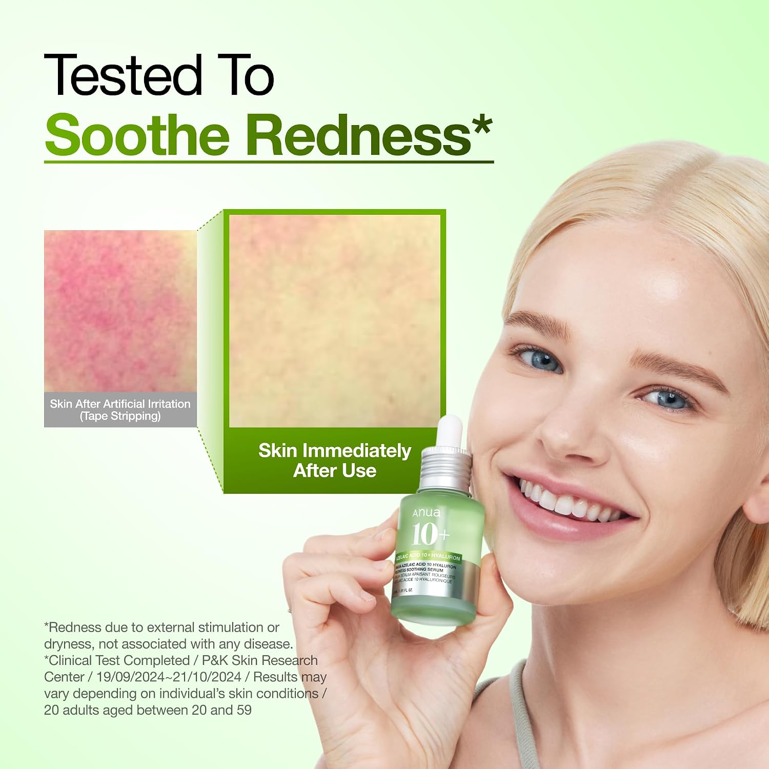 Anua Azelaic Acid 10 Hyaluron Redness Soothing Serum