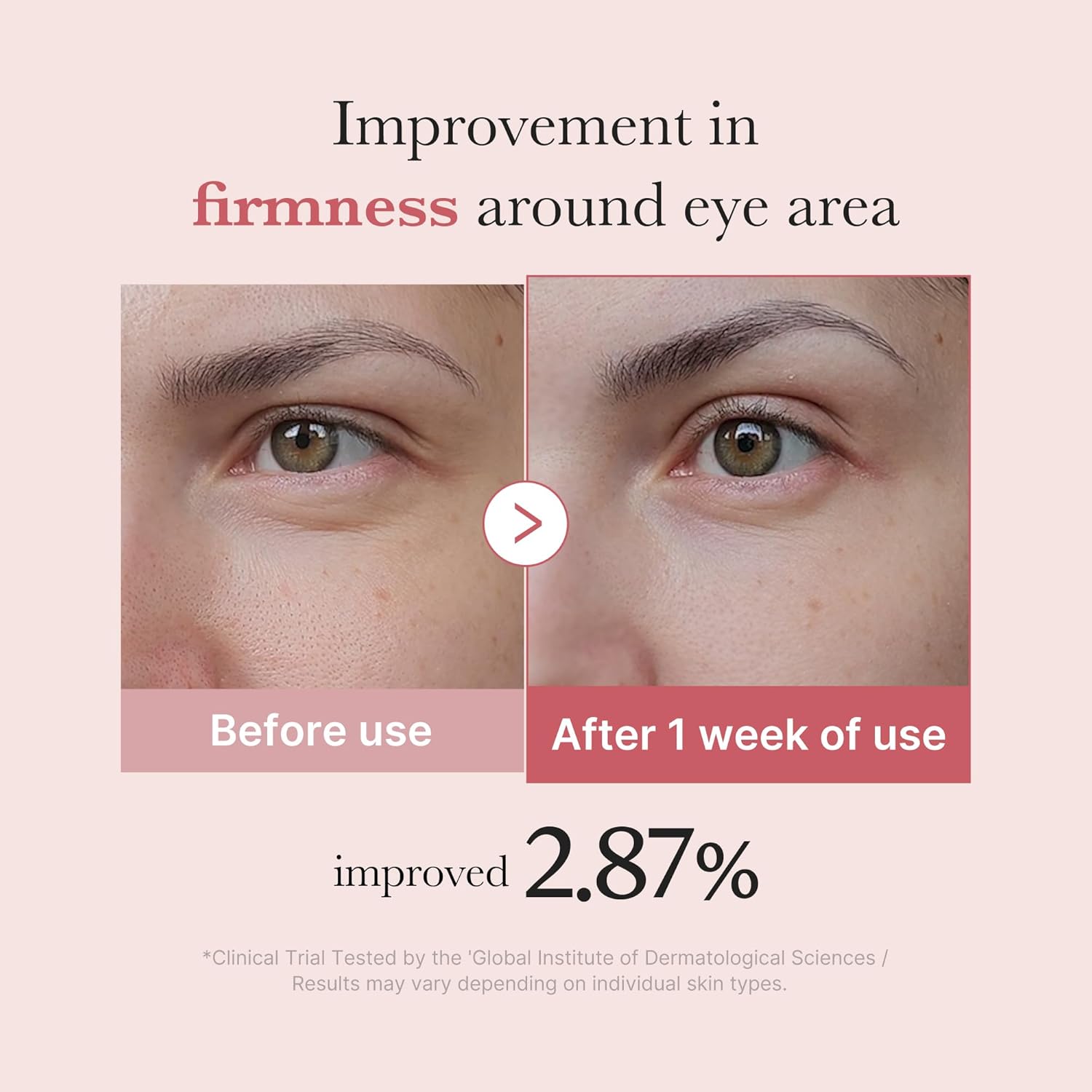 medicube PDRN Pink Peptide Eye Cream 30ml | Korean Skincare
