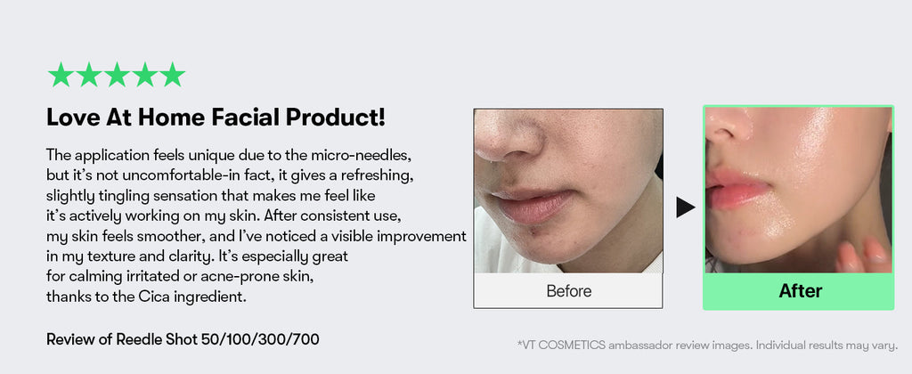 VT CICA Reedle Shot 300 50ml, Korean Skin Care