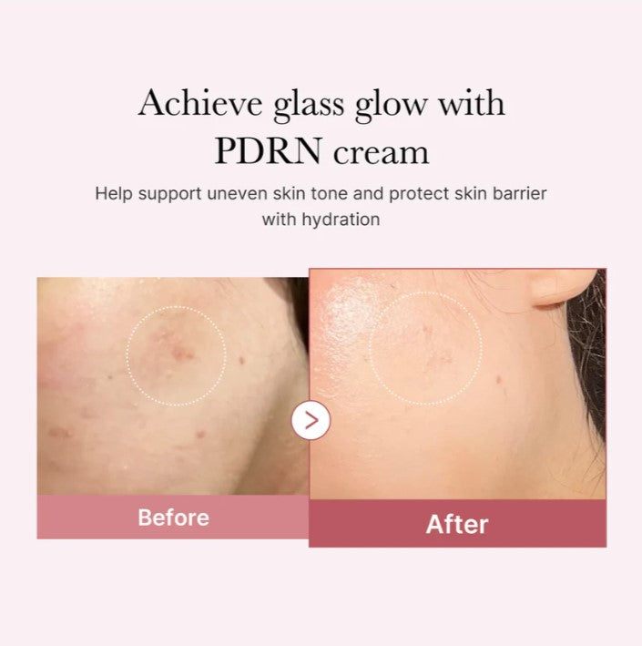 medicube PDRN Pink hyaluronic Moisturizing Cream 50ml, Korean Skin Care