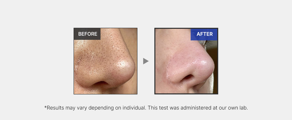medicube Exosome Shot Pore Serum for All Skin Types