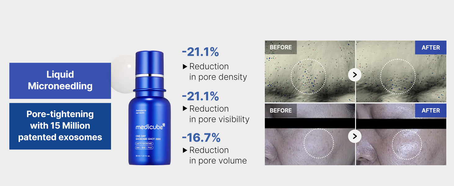 medicube Exosome Shot Pore Serum for All Skin Types
