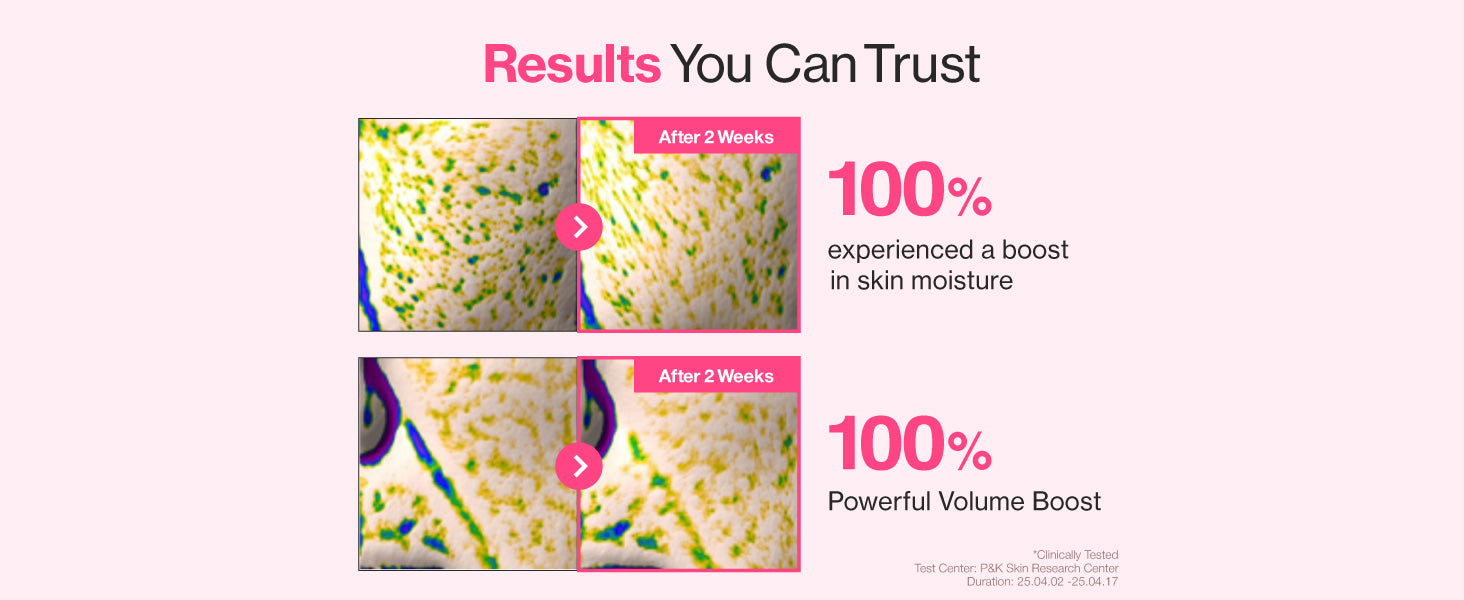 numbuzin No.2 Rose PDRN Collagen Plumping Mask 33ml 5sheets