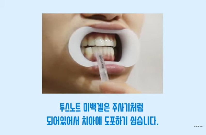 tooth note Teeth Whitening Gel Kit for 2 Weeks, Korean Oral Care