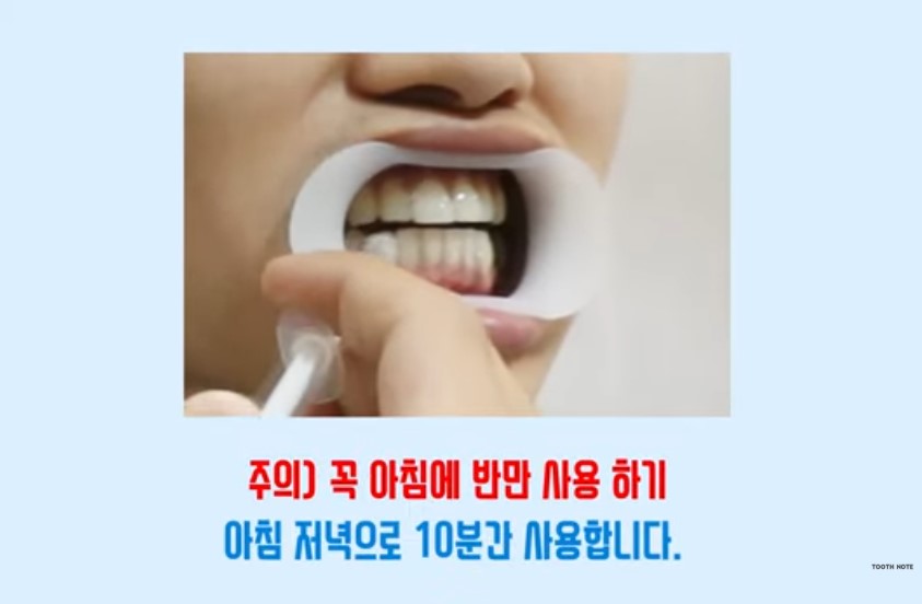 tooth note Teeth Whitening Gel Kit for 2 Weeks, Korean Oral Care