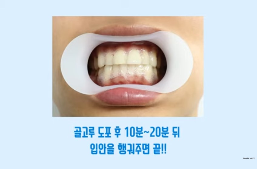 tooth note Teeth Whitening Gel Kit for 2 Weeks, Korean Oral Care
